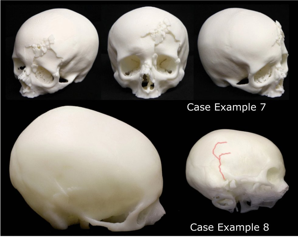 Non-lethal skull damages.jpg